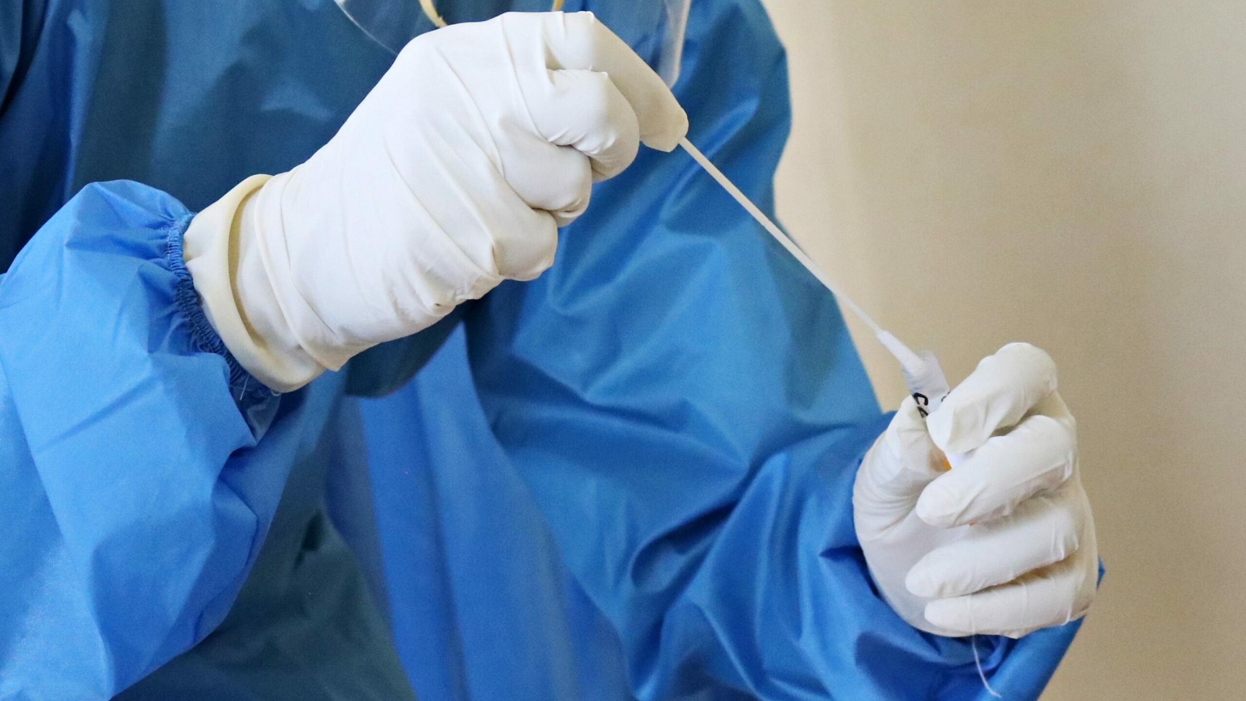 В Петербурге за последние сутки выявили 1 418 новых случаев коронавируса