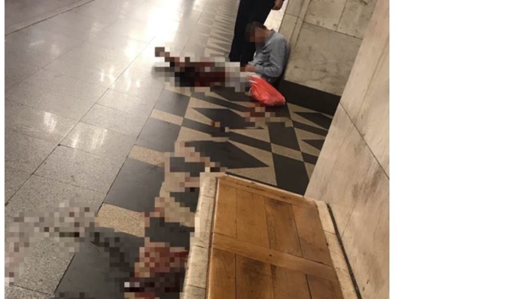 Петербуржец с окровавленными ногами на станции метро «Нарвская» рассказал, что с ним случилось
