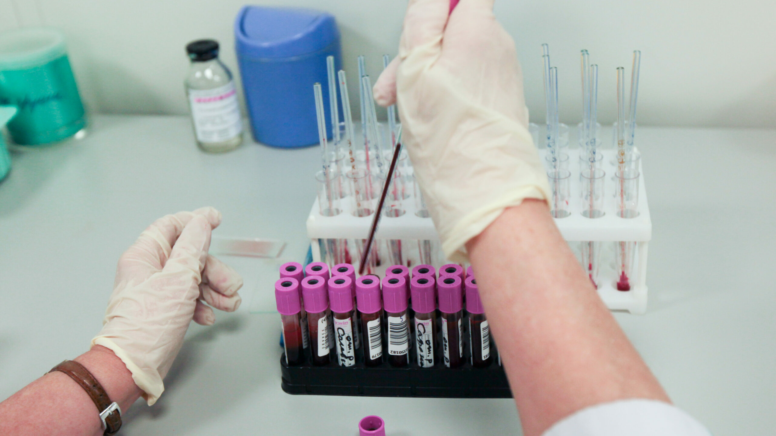Биолог ответила, способен ли коронавирус вызвать СПИД