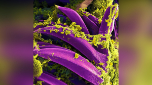Снова чума: эволюция смертоносной бактерии может угрожать существованию человечества