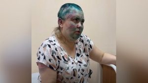 Избитая в Чечне журналистка Милашину выписана из больницы