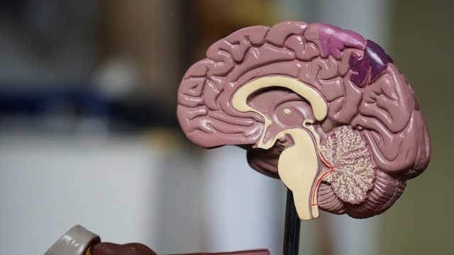 Японские ученые выявили ключ к самовосстановлению мозга после инсульта