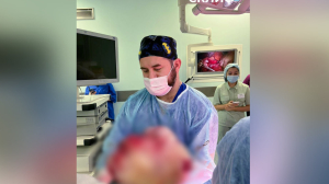 Зубастая опухоль: в НИИ имени Склифосовского женщине вырезали гигантскую грыжу