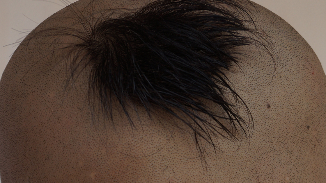 Секс на Новый год: петербуржцы массово делают эти интимные стрижки, чтобы пошалить под елкой — самые популярные узоры