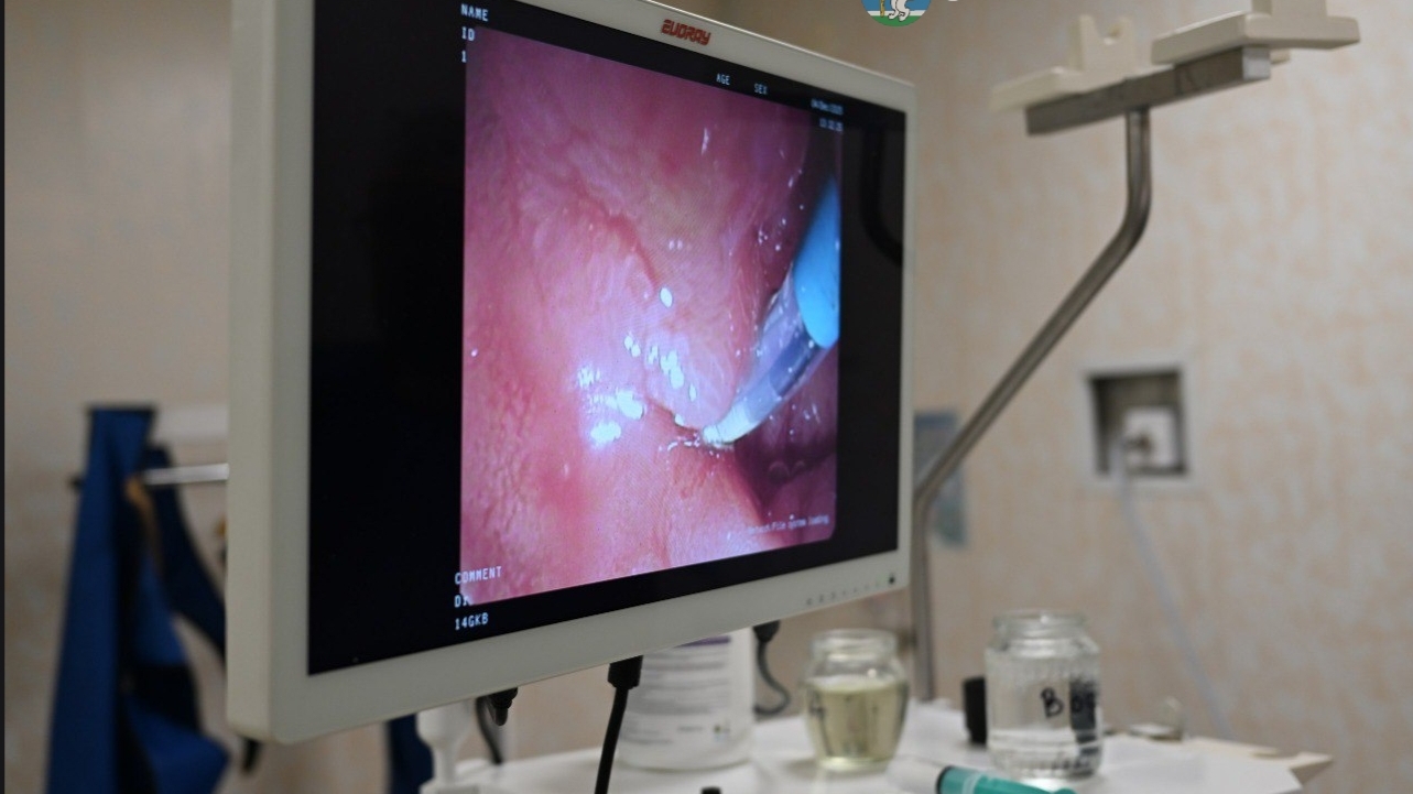 В хорроре снимались беззубая пенсионерка и сосиска-убийца: россиянка чуть не умерла после ужина