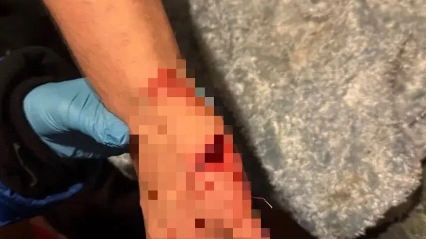 Петербургский агрессор полосанул ножом друга во время пьянки