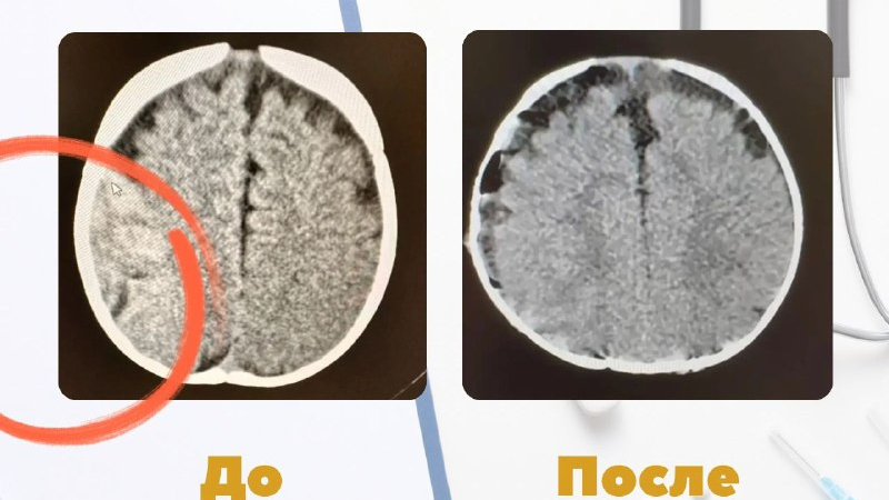 В Петербурге перед Новым годом спасали шестимесячного малыша, упавшего с кровати