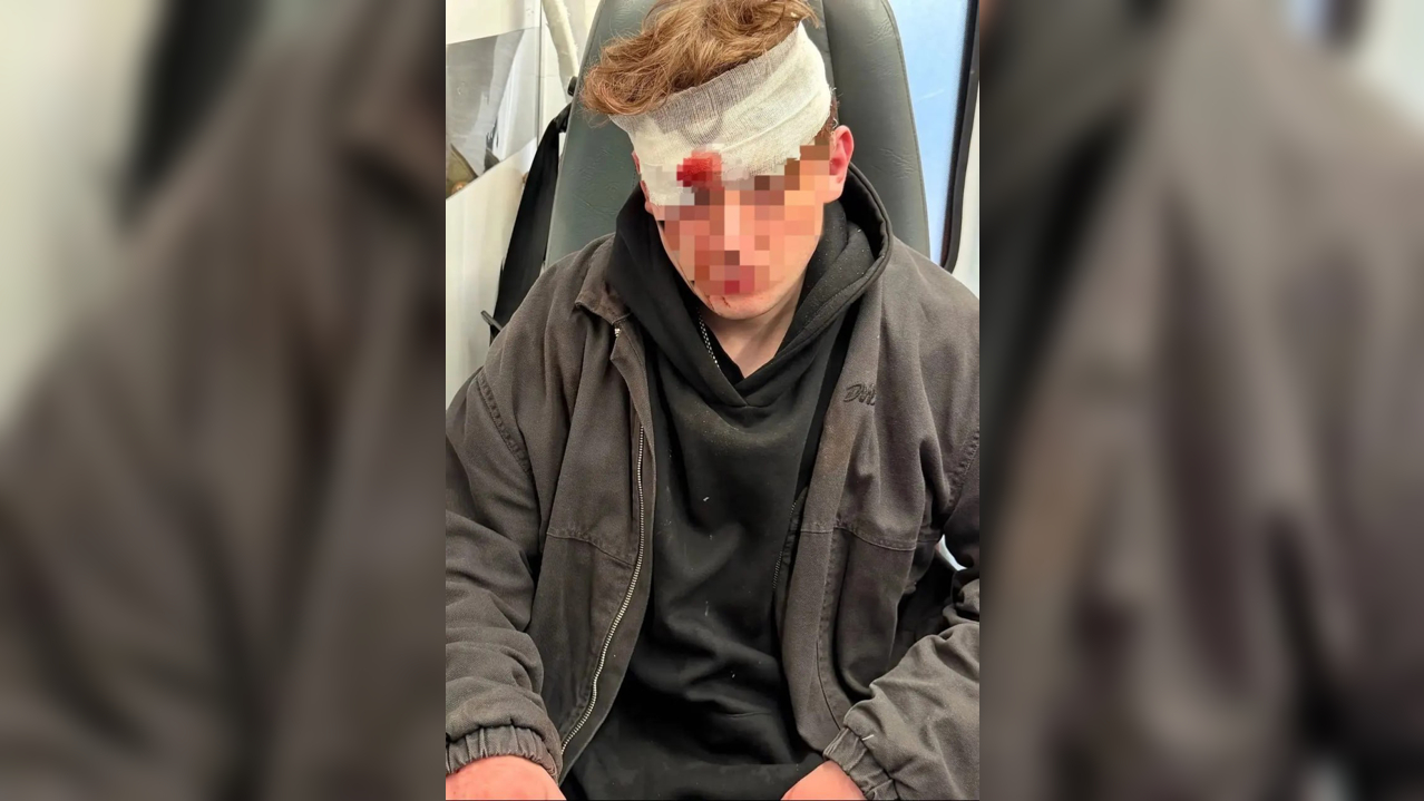 Петербуржец выстрелил из сигнального пистолета в голову оппонента вместо аргументов у бара на Владимирском