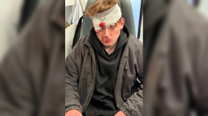 Петербуржец выстрелил из сигнального пистолета в голову оппонента вместо аргументов у бара на Владимирском