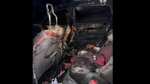 «Прости меня, если сможешь». Петербурженка извинилась перед любовницей с ожогами на лице после поджога