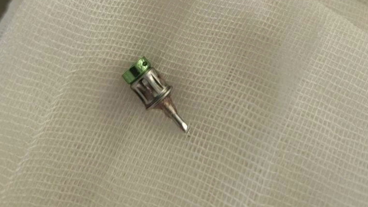 Из бронхов пациента стоматологической клиники в Подмосковье достали сверло