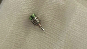 Из бронхов пациента стоматологической клиники в Подмосковье достали сверло